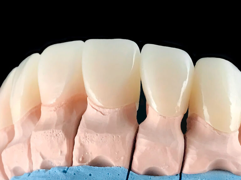 Endodontist Kelowna PainFree Root Canal Treatments